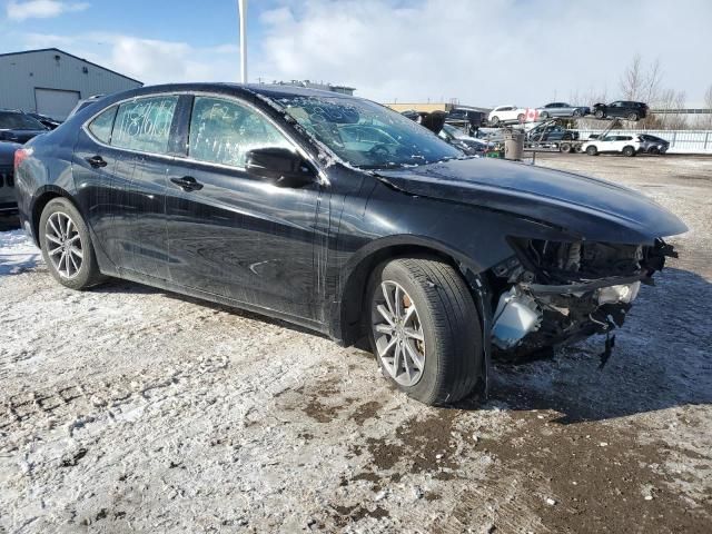 2017 Acura TLX Tech