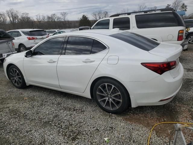 2015 Acura TLX Tech