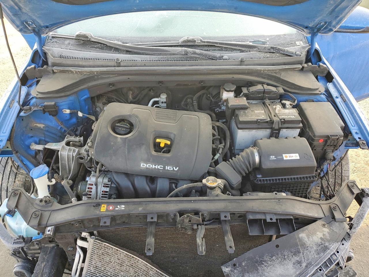 2017 Hyundai Elantra se