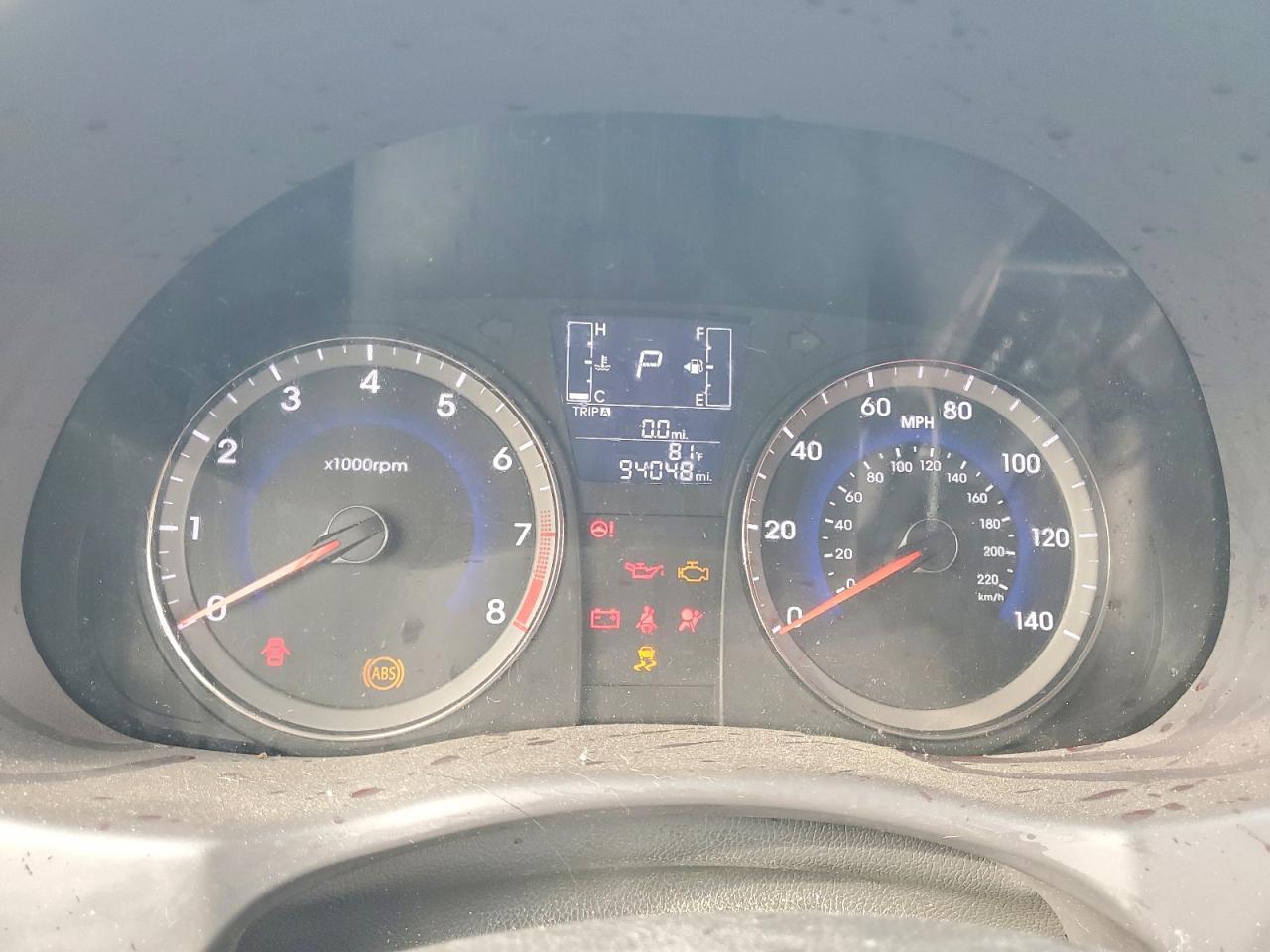 2017 Hyundai Accent se