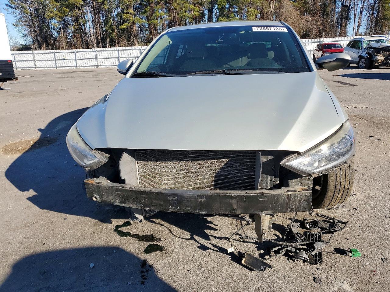2017 Hyundai Elantra Value Edition