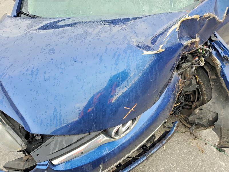 2015 Hyundai Elantra