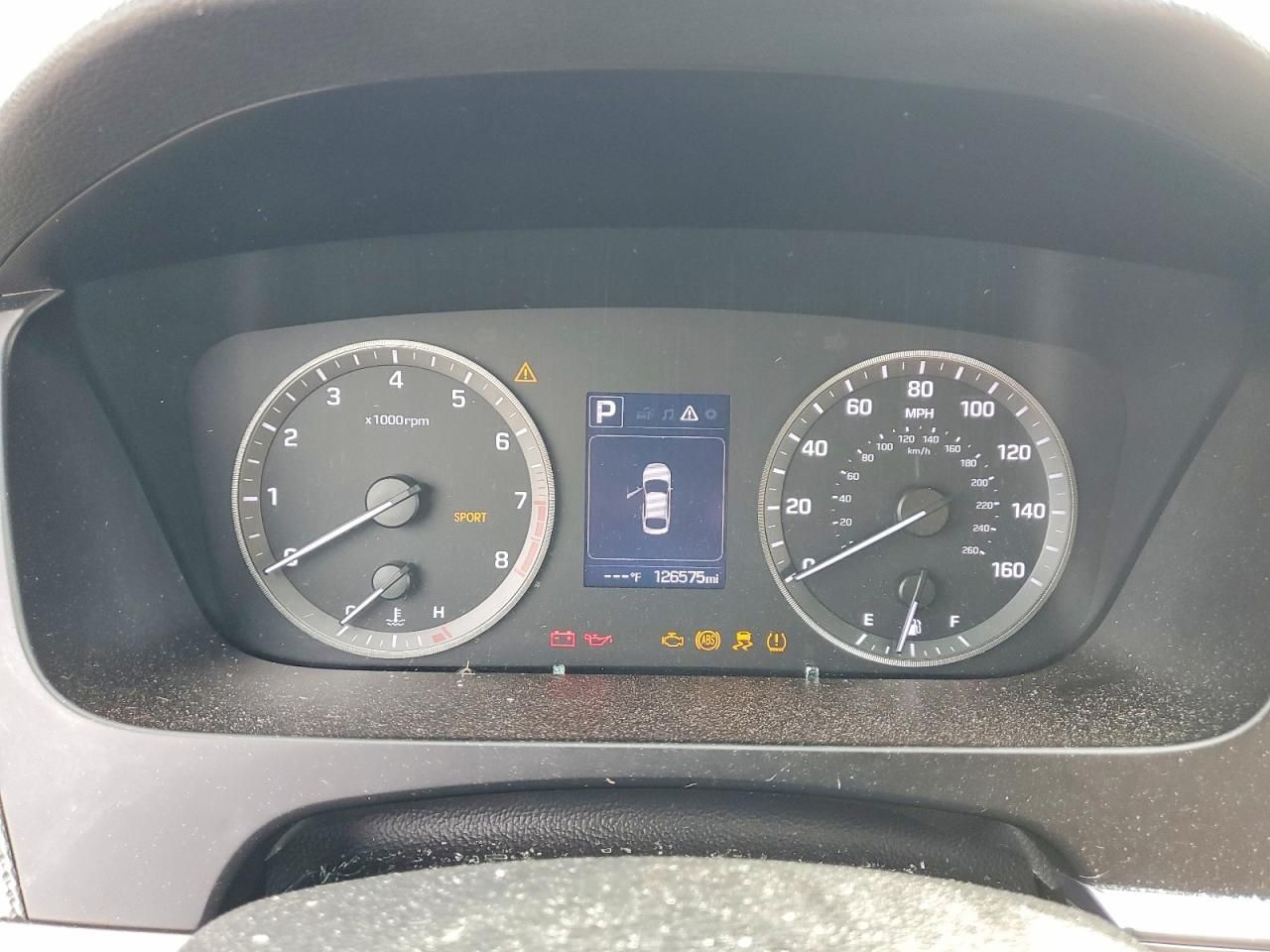 2017 Hyundai Sonata se