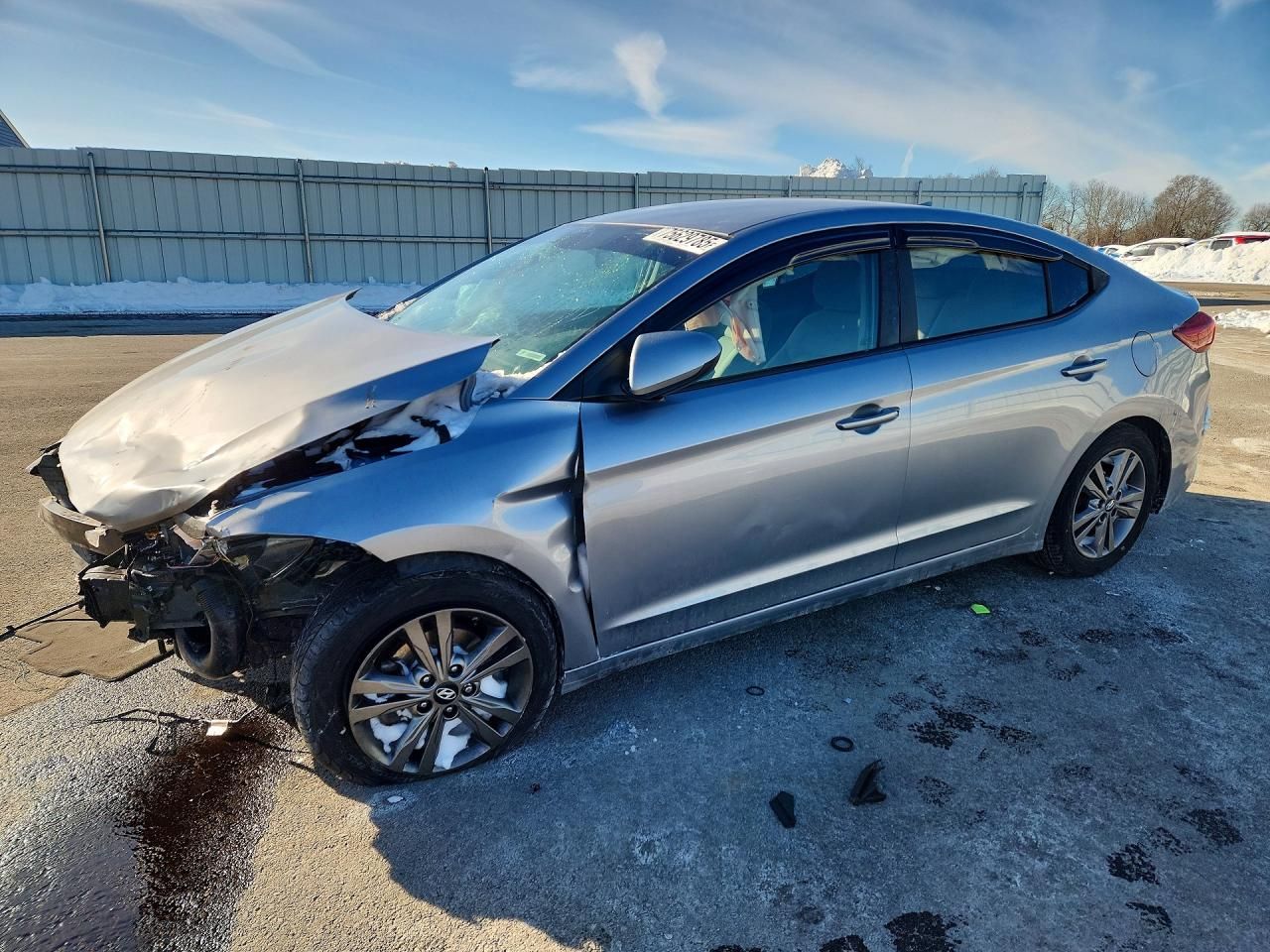 2017 Hyundai Elantra se