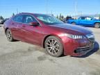 2015 Acura Tlx Tech