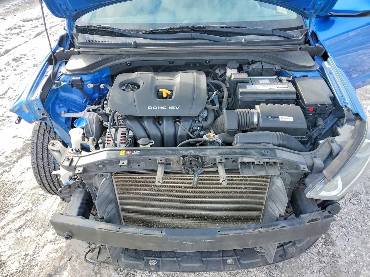 2017 Hyundai Elantra se