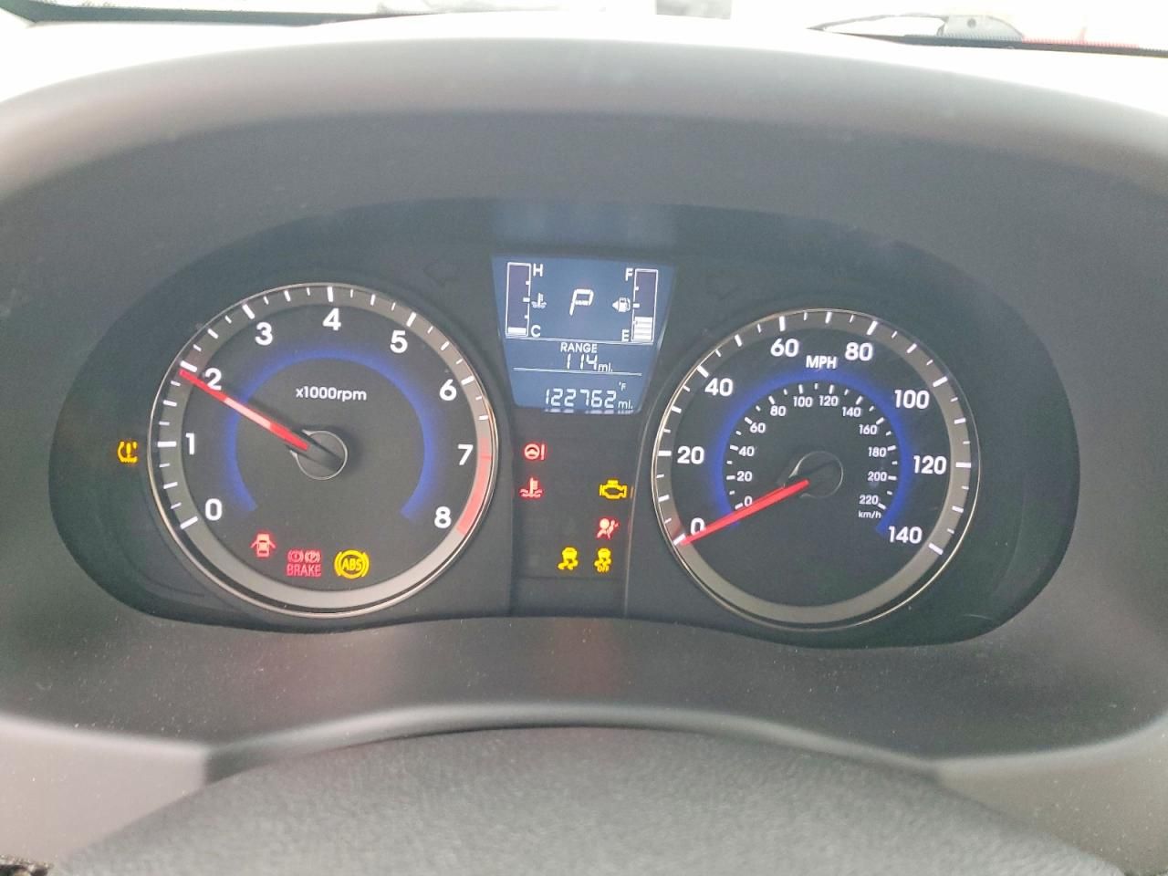 2017 Hyundai Accent se