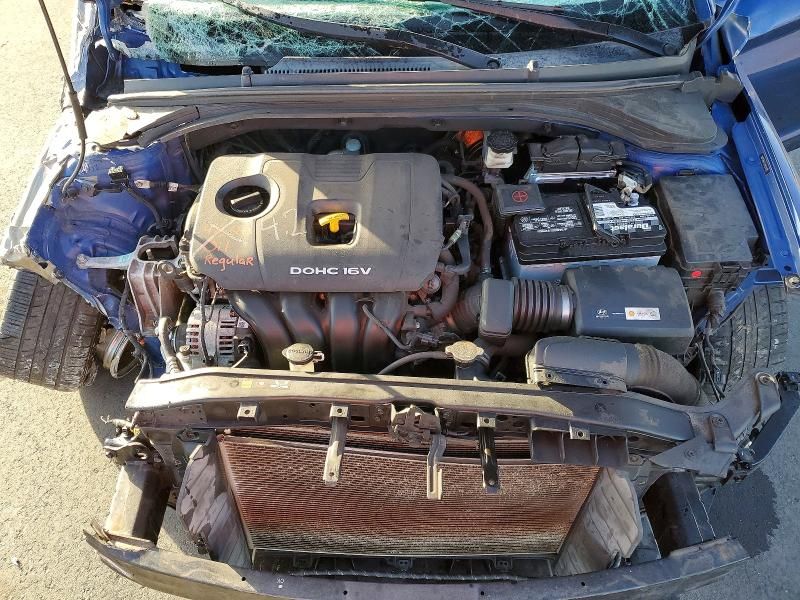 2017 Hyundai Elantra se