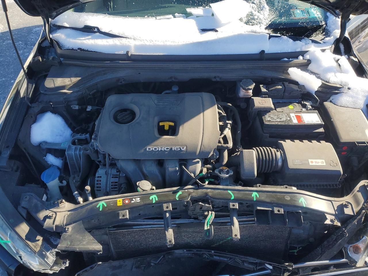 2017 Hyundai Elantra se