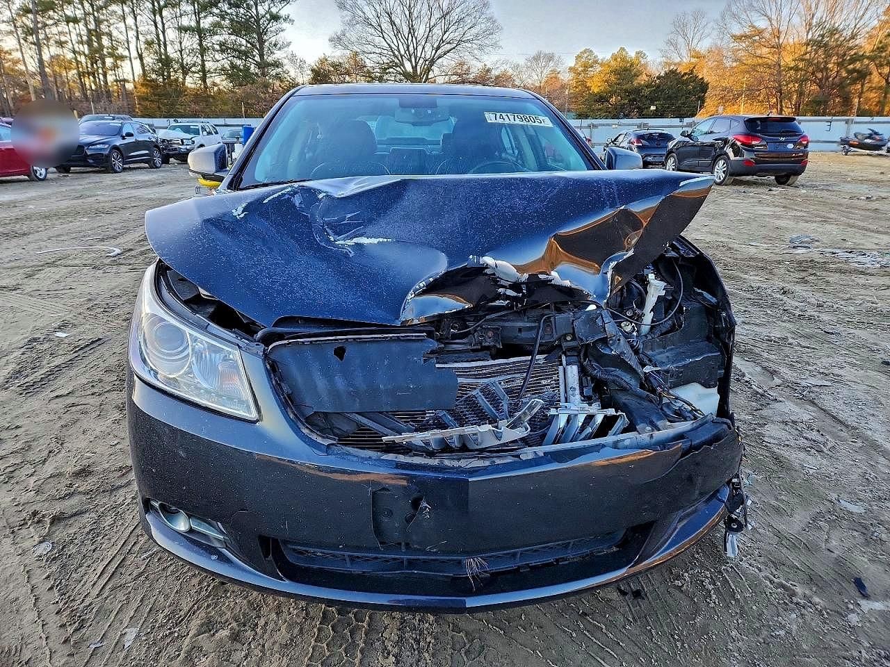 2011 Buick Lacrosse cxs
