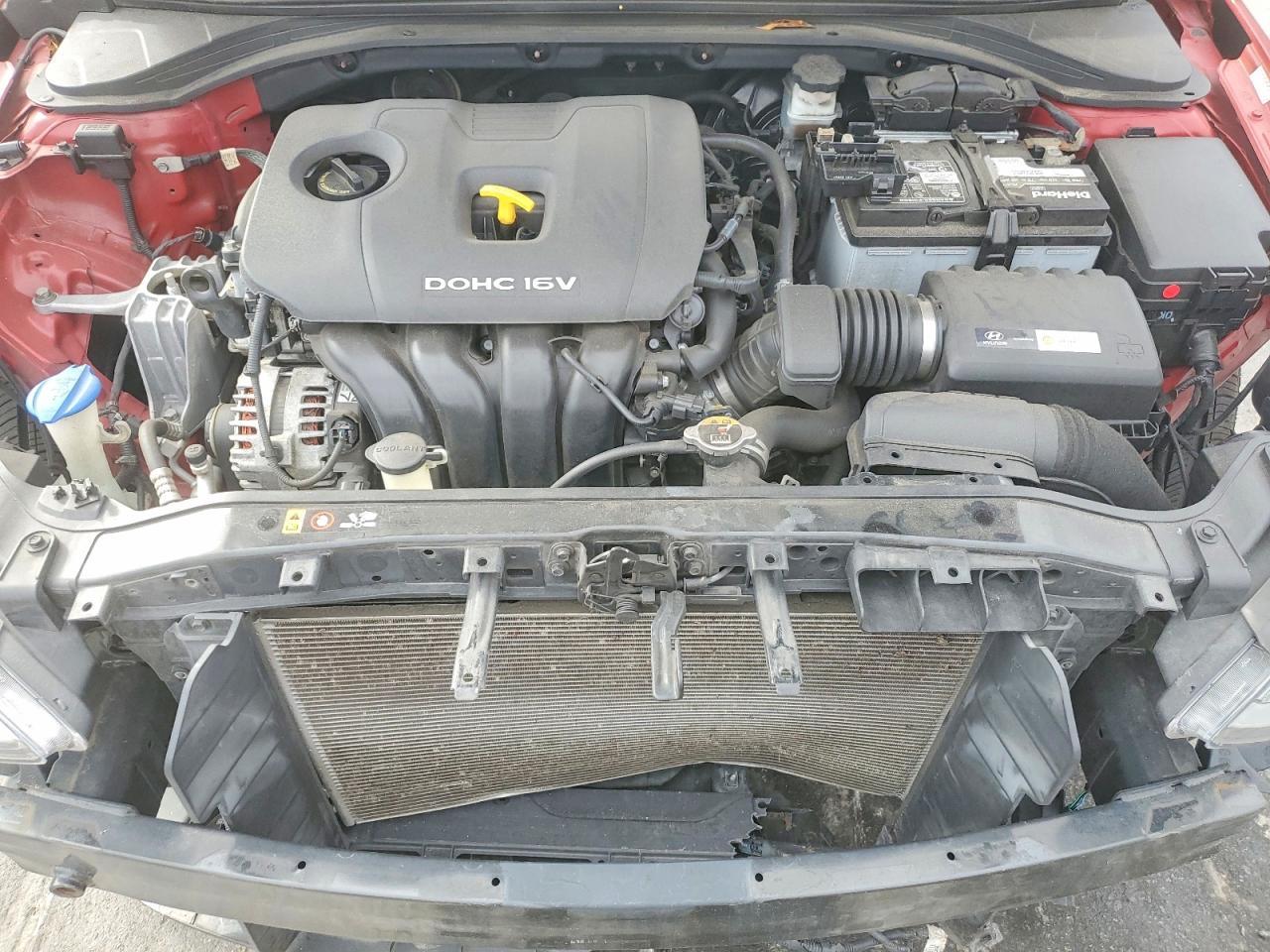 2017 Hyundai Elantra se