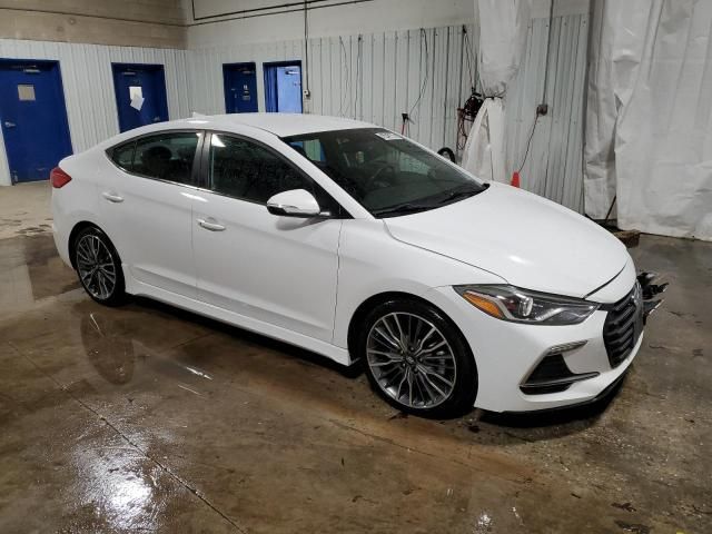 2017 Hyundai Elantra Sport