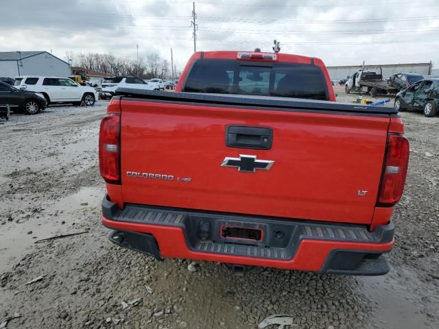 2018 Chevrolet Colorado LT