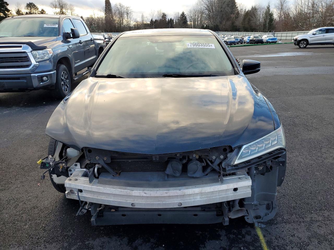 2015 Acura Tlx Tech