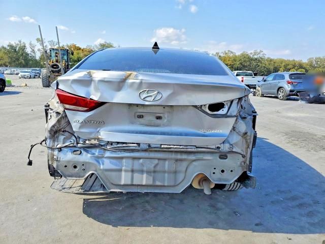 2017 Hyundai Elantra se