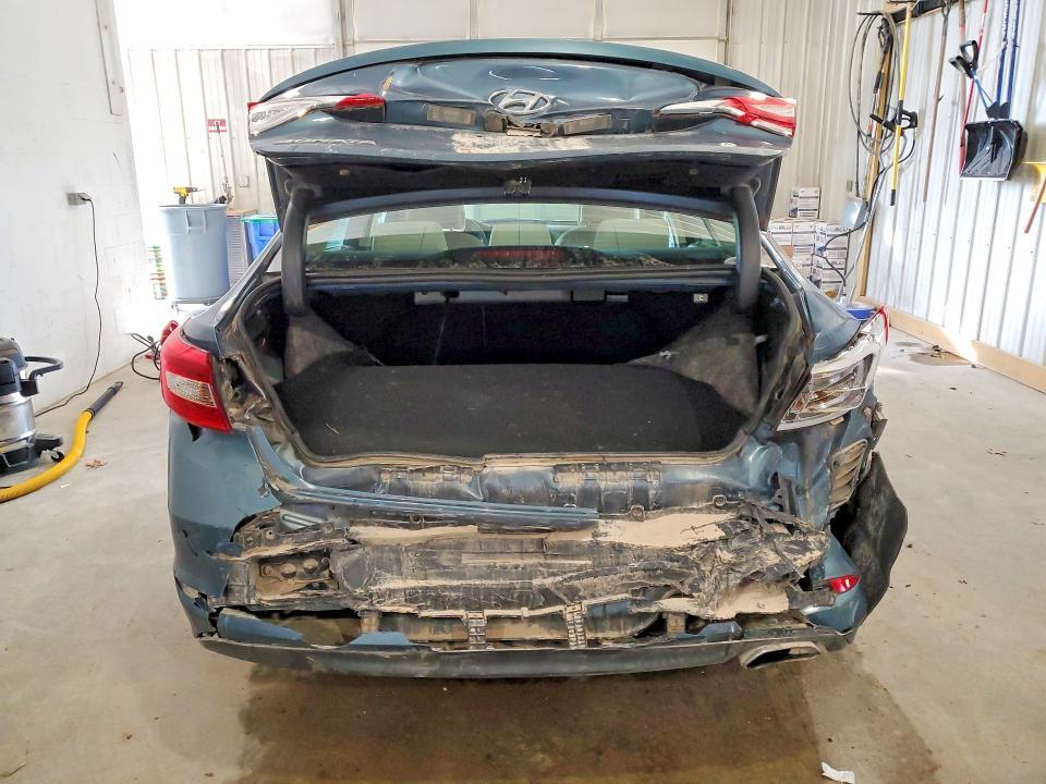 2015 Hyundai Sonata se