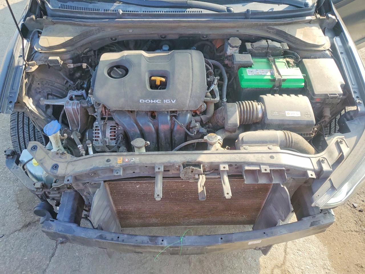 2017 Hyundai Elantra se