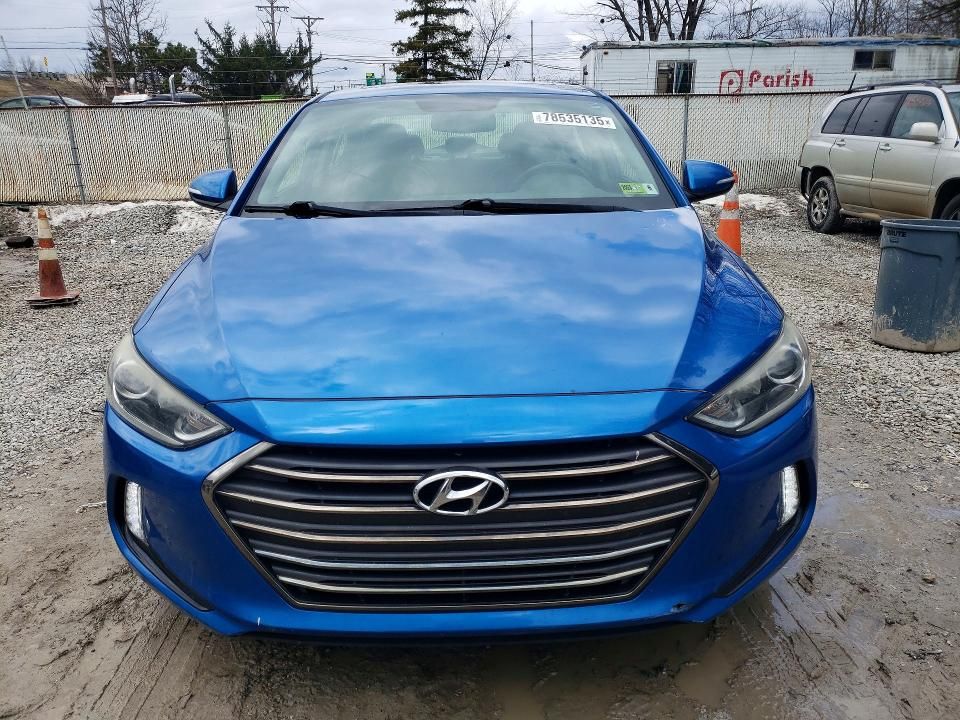 2017 Hyundai Elantra se