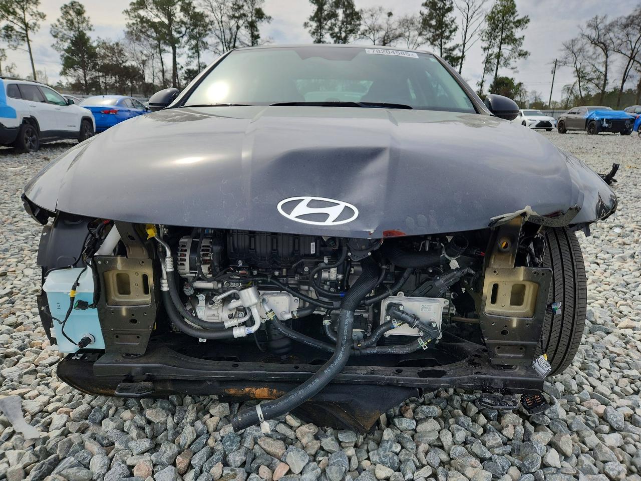 2025 Hyundai Sonata se