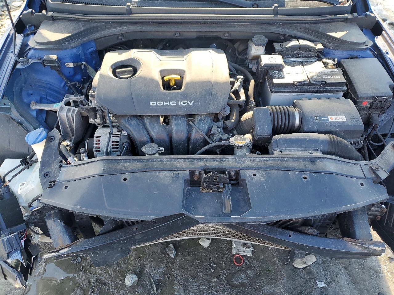 2017 Hyundai Elantra se