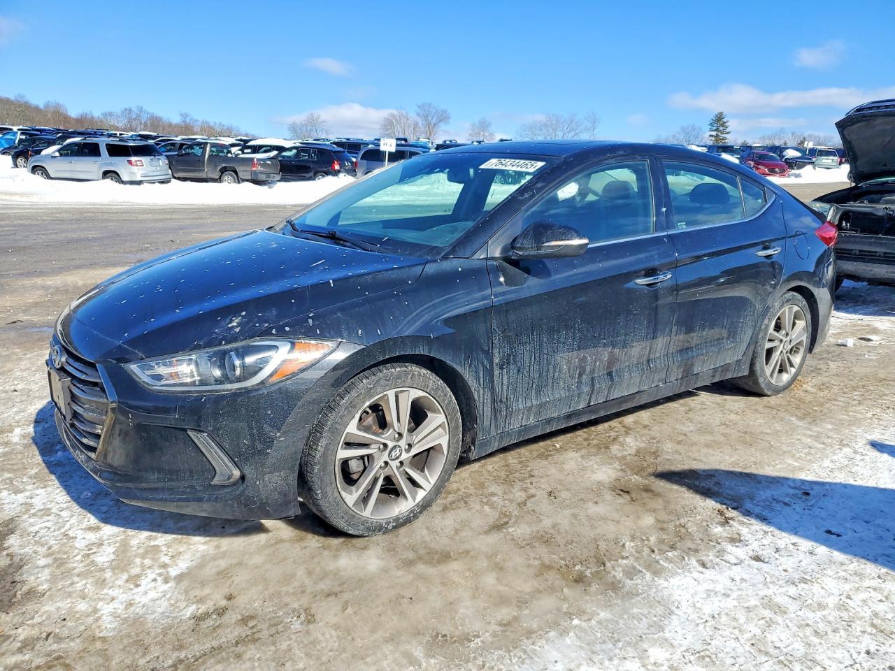 2017 Hyundai Elantra se