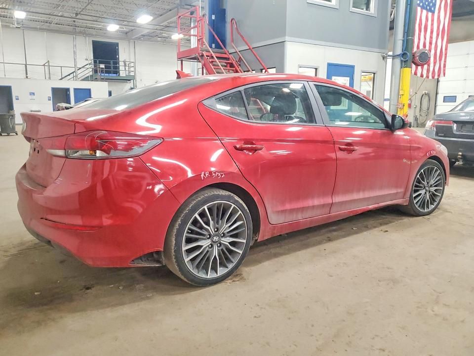 2017 Hyundai Elantra se