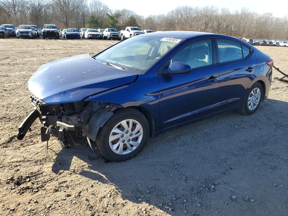 2017 Hyundai Elantra se