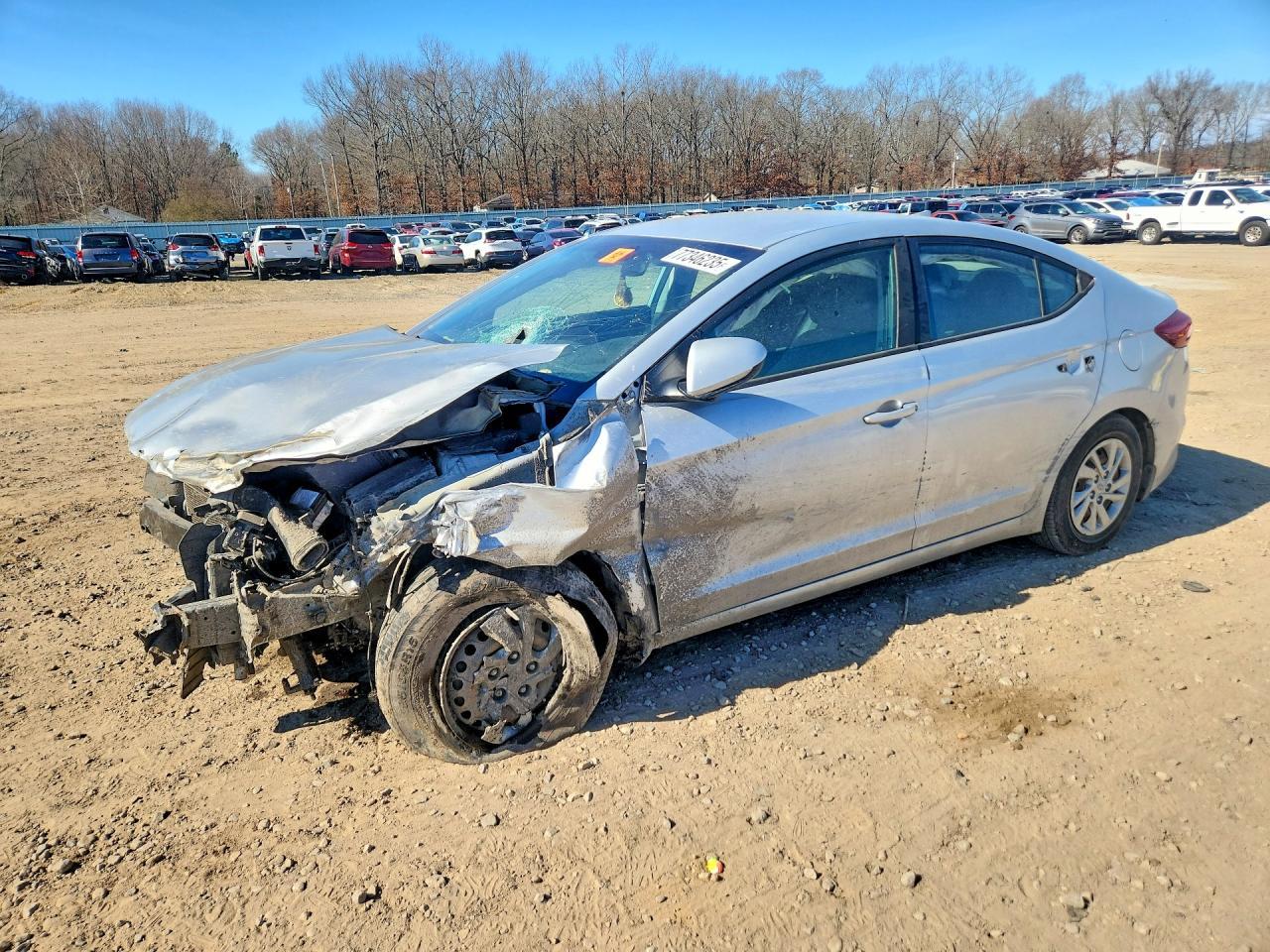 2017 Hyundai Elantra se