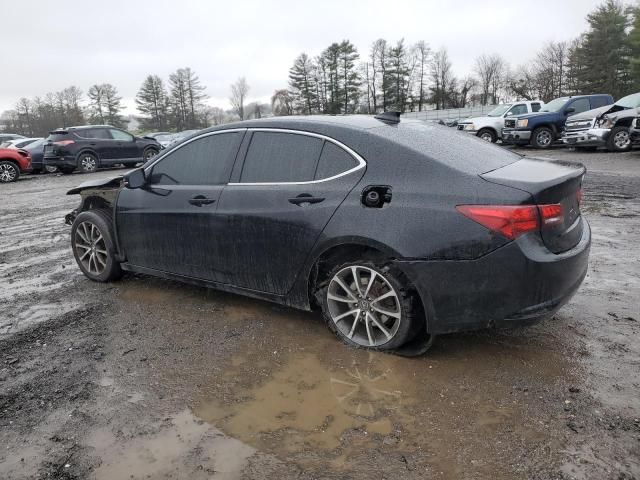 2015 Acura TLX Tech