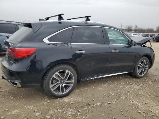 2017 Acura MDX Advance