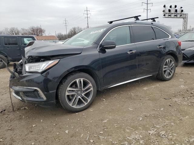 2017 Acura MDX Advance