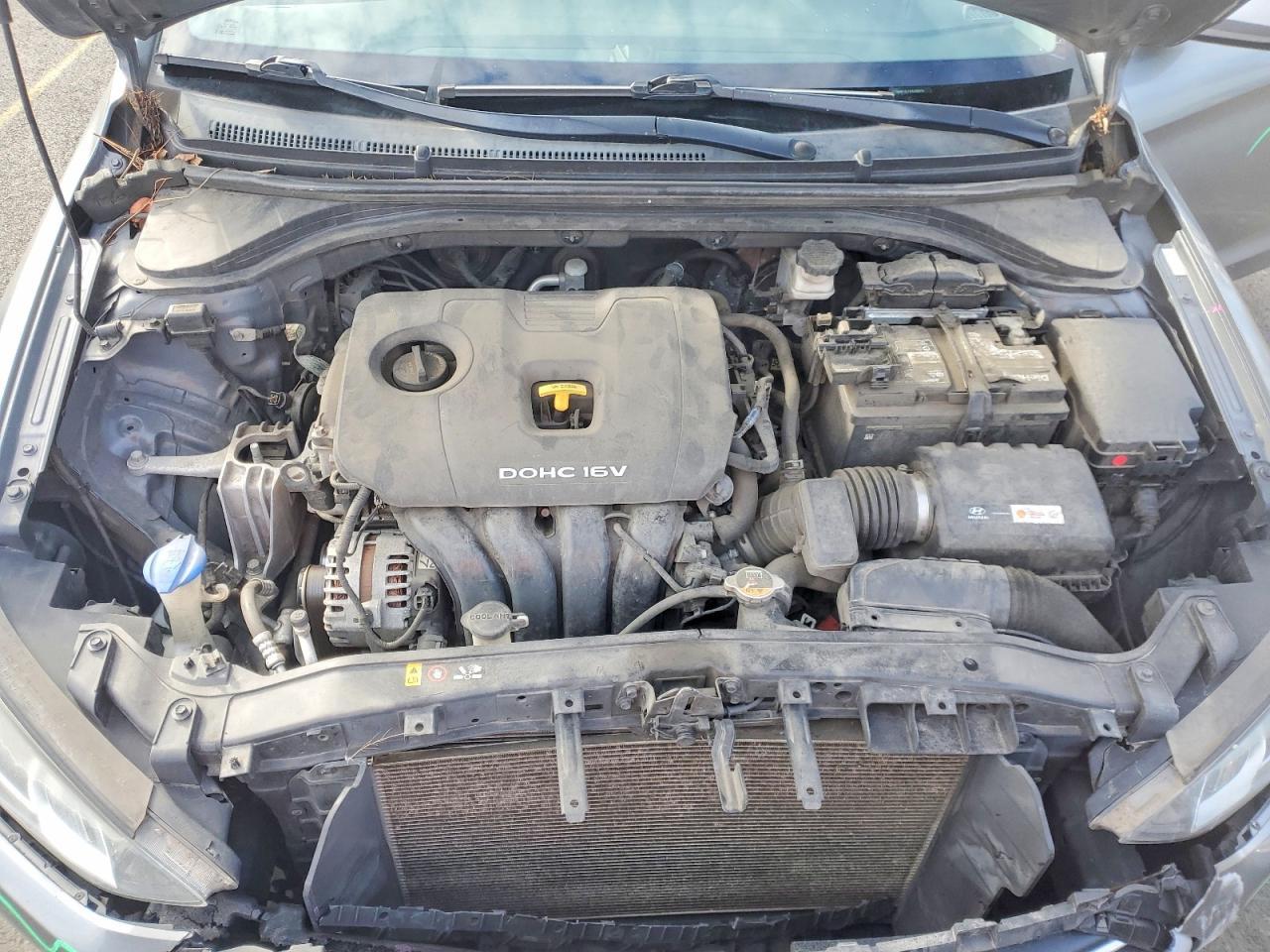 2017 Hyundai Elantra se