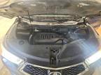 2017 Acura Mdx Advance
