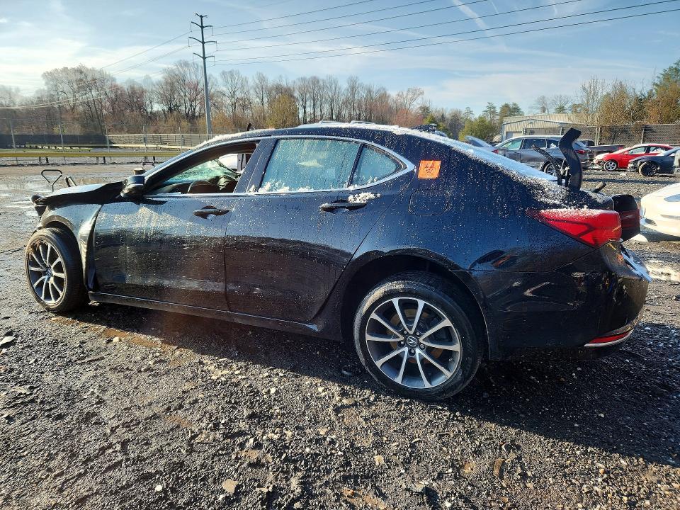 2015 Acura Tlx Advance