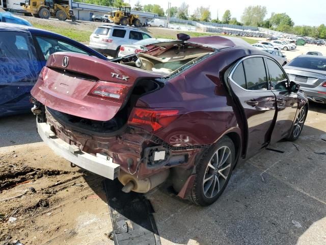 2016 Acura TLX Tech