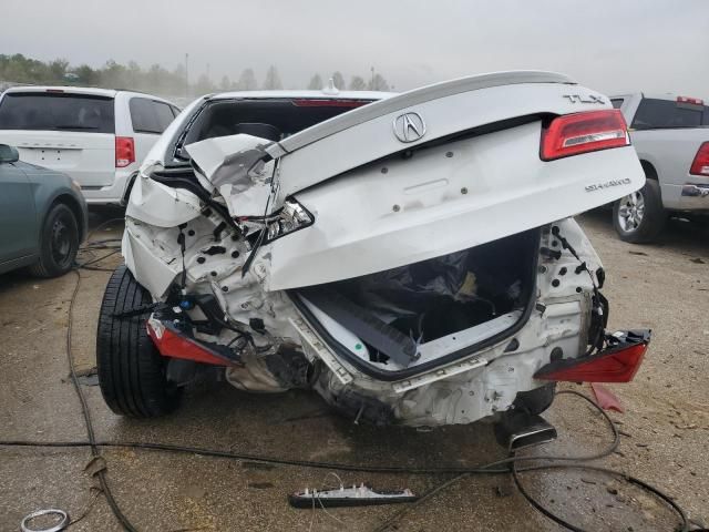 2018 Acura TLX Advance