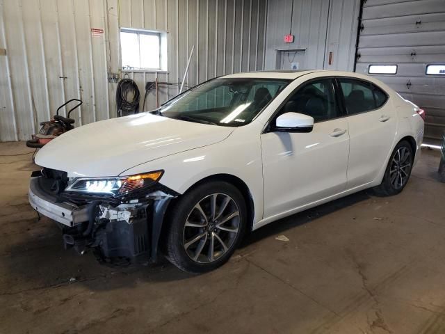 2015 Acura TLX Tech