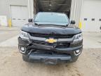 2015 Chevrolet Colorado Z71