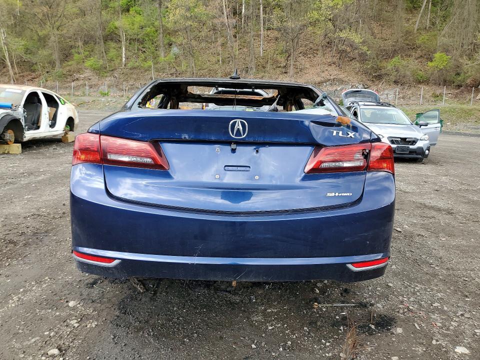 2015 Acura Tlx Tech