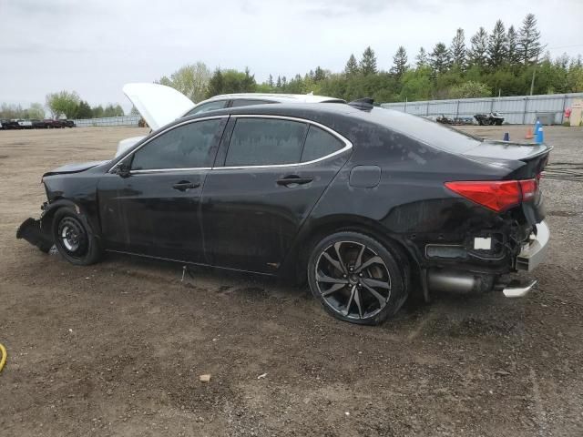 2018 Acura TLX Advance