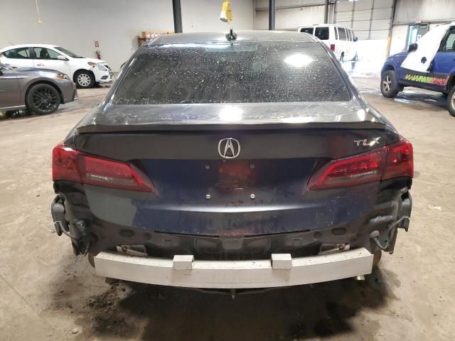 2015 Acura TLX Tech