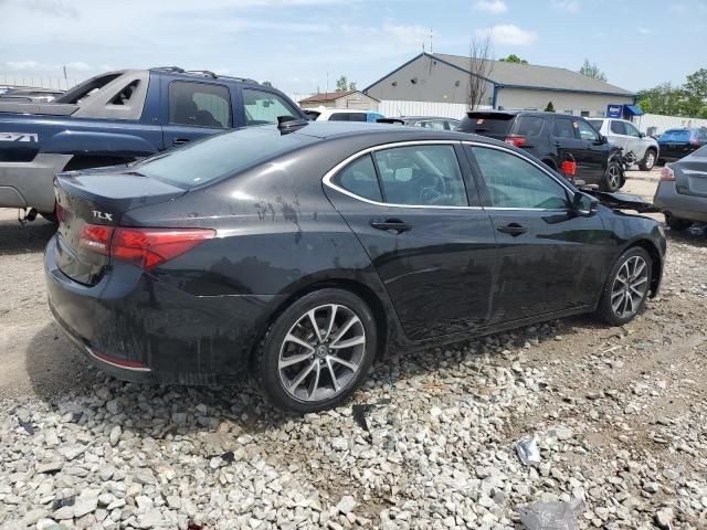 2017 Acura TLX Tech