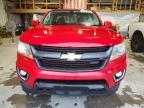 2015 Chevrolet Colorado Z71