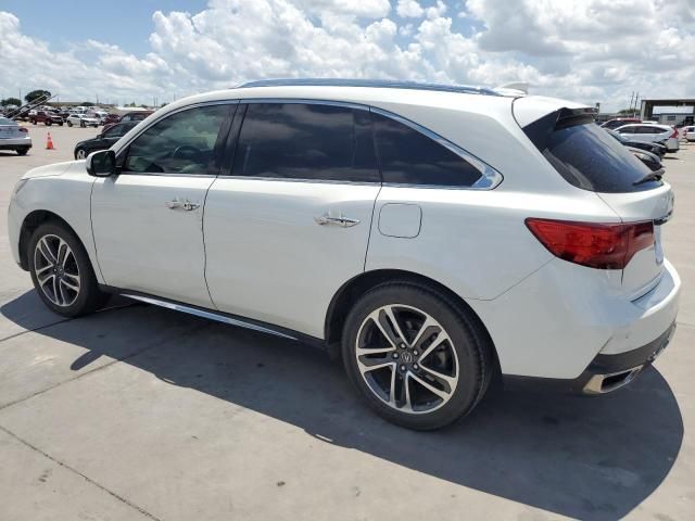 2017 Acura MDX Advance