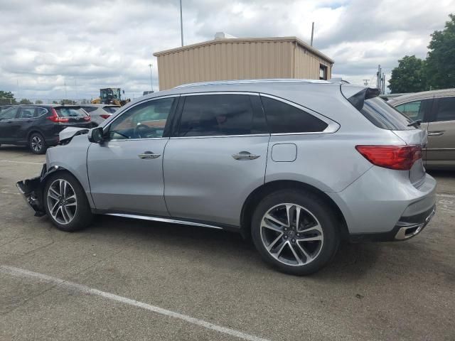 2017 Acura MDX Advance