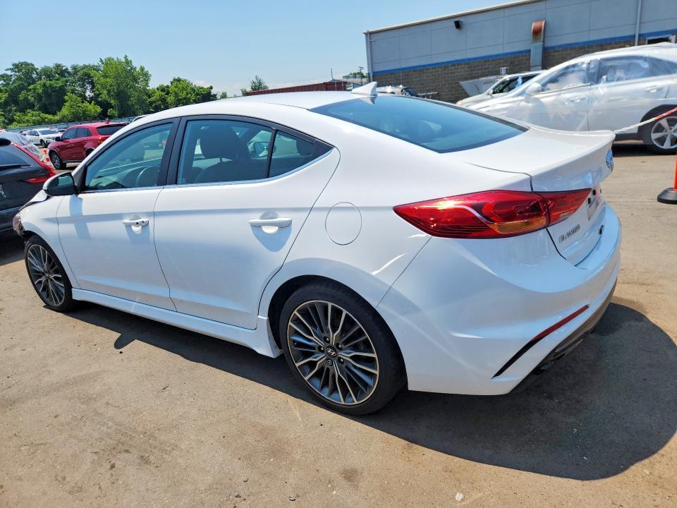 2017 Hyundai Elantra Sport