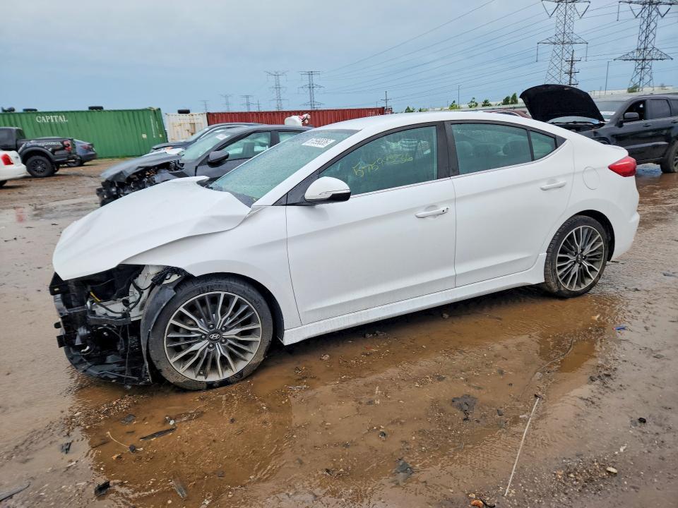 2017 Hyundai Elantra Sport