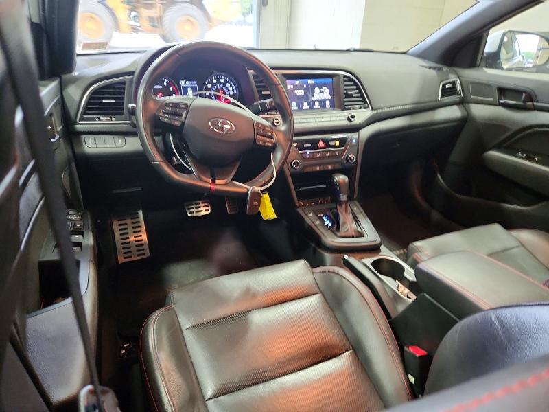 2017 Hyundai Elantra Sport
