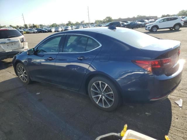 2015 Acura TLX Tech