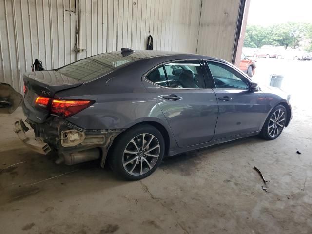 2017 Acura Tlx Tech
